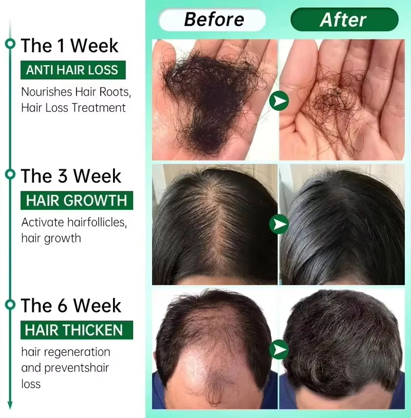 Serum na porost włosów 7-dniow – Growth Factor Serum recenzja i cena