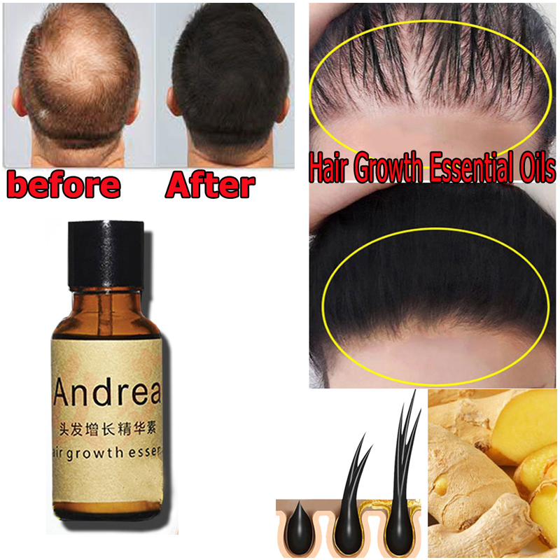 2/5/10Pcs Andrea Hair Growth S – Growth Factor Serum recenzja i cena